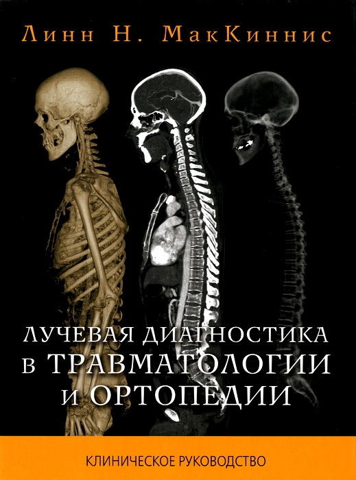 скачать рыбакова практическое руководство эхокардиография